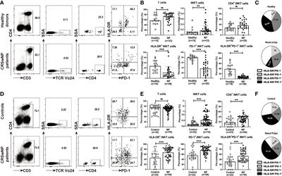 Type 2 and Type 17 Invariant Natural Killer T Cells Contribute to Local Eosinophilic and Neutrophilic Inflammation and Their Function Is Regulated by Mucosal Microenvironment in Nasal Polyps